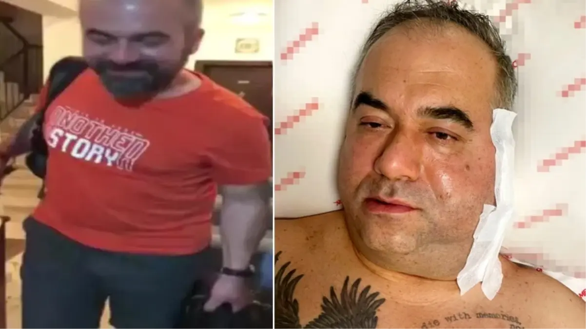 Pilotun ameliyatta ölümünde korkunç iddia! "Doktor bey hasta çok kötü"